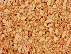 GRIN2A Antibody
