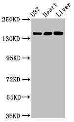 GRIN2A antibody