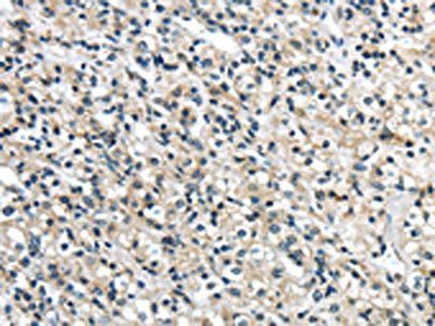 GRIN2A Antibody