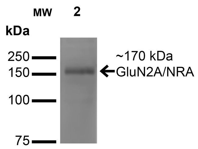 NMDAR2A NMDA Antibody