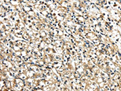 NME2 Antibody