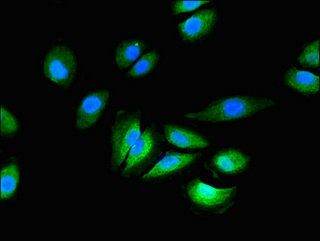 GRIN2C Antibody
