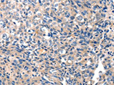 GRIN2D Antibody