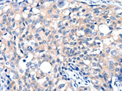 GRIN2D Antibody