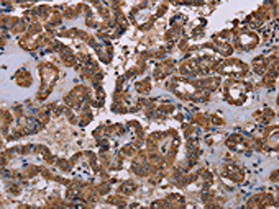 GRK1 antibody