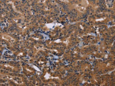 GRK1 Antibody