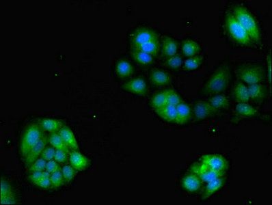 GRK4 Antibody