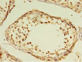 GRK4 Antibody