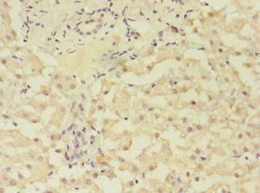 GRK4 Antibody