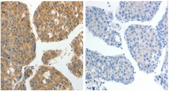 GRK4 Antibody