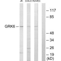 GRK6 antibody
