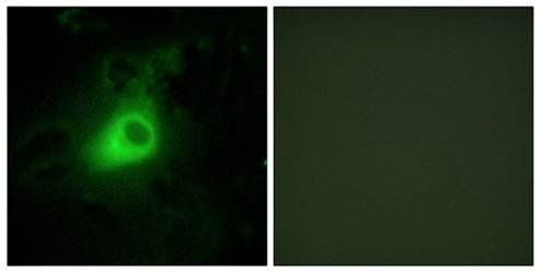 GRK6 Antibody
