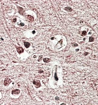 Goat anti-GRM2 Antibody