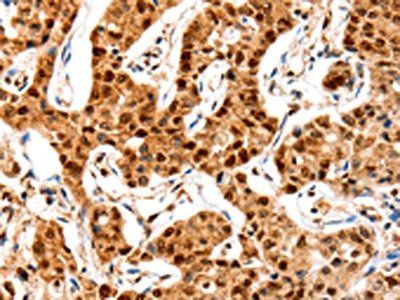 GRM4 Antibody