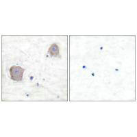 GRM4 Antibody