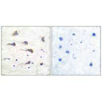 GRM6 Antibody