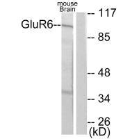 GRM6 antibody