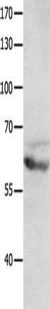 GRM8 antibody