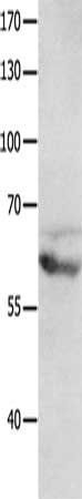 GRM8 Antibody
