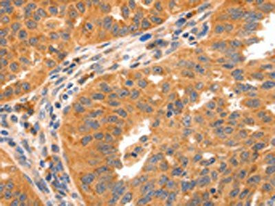 GRM8 Antibody