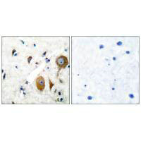 GRM8 antibody