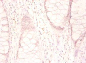 GDF15 Antibody