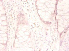 Growth/differentiation factor 15 antibody