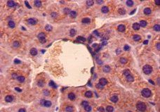 Gdf5 Antibody
