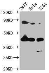 Growth/differentiation factor 8 antibody