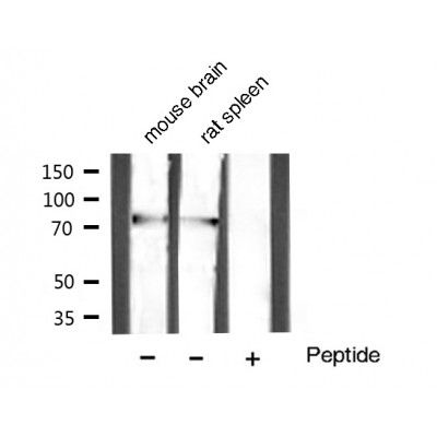 GRP78 antibody