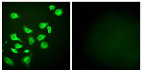 GRP94 antibody