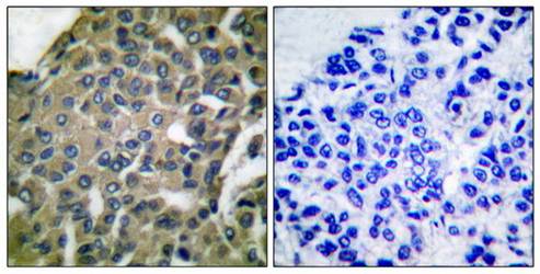 GRP94 antibody