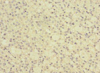 GRPEL2 Antibody