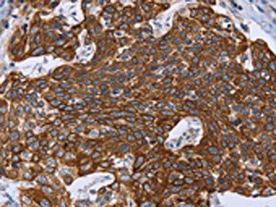 GRPR Antibody