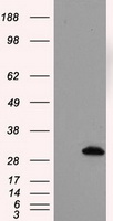 GSC Antibody