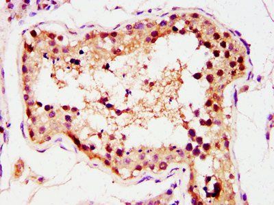 GSC Antibody