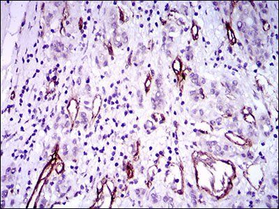 GSC Antibody