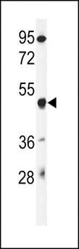 GSDMA antibody