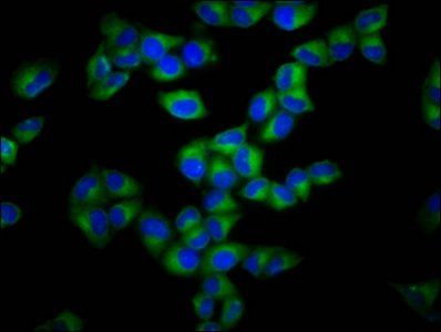 GSDMA Antibody