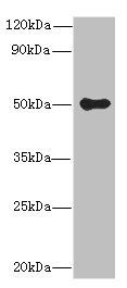 GSDMB antibody
