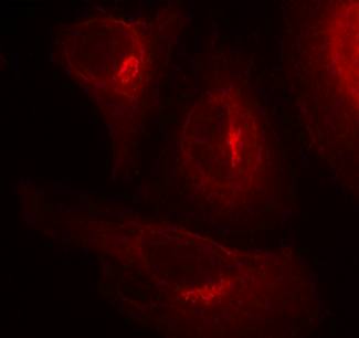 GSK3α (Phospho-Ser21) Antibody