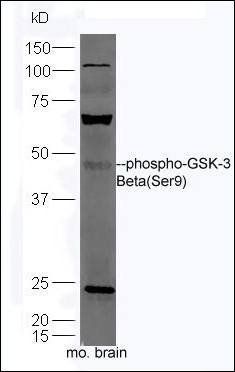 GSK3 beta (phospho-Ser9) antibody