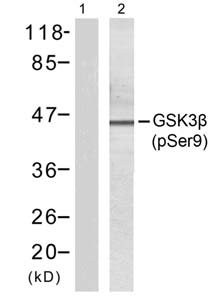 GSK3β (Phospho-Ser9) Antibody