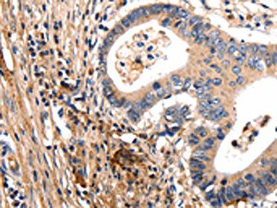 GSK3A Antibody