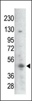 GSK3B (phospho-Ser21/29) antibody
