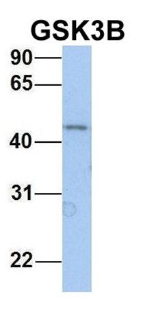 GSK3B antibody