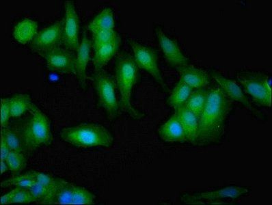 GSN Antibody
