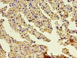 GSN Antibody