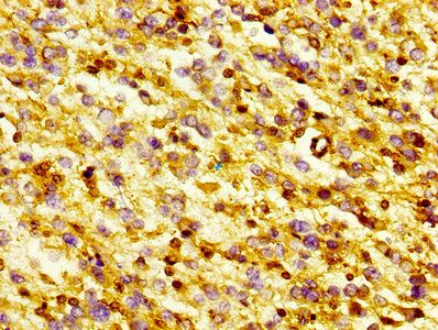 GSN Antibody