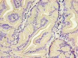 GSN Antibody